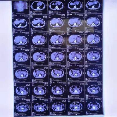 Разумная стоимость Медицинские рентгеновские пленки с высокой стабильностью изображения, обеспечивающие четкие и точные диагностические изображения