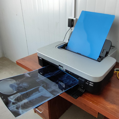 Фильм струйного принтера канона Epson фильма голубого ЛЮБИМЦА дюйма 14*17 медицинский струйный