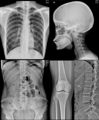 Фильм Г-НА DR цифров x Рэй CR CT фильма A3 A4 медицинский водоустойчивый струйный