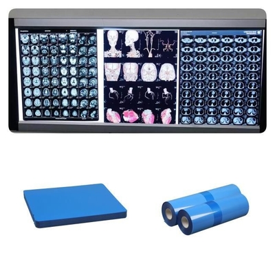 Canon/Epson Inkjet X Ray Film низкий туман 1-3 минуты Скорость печати