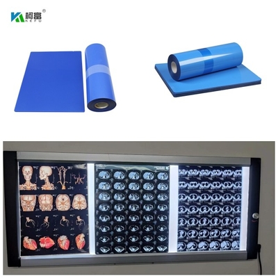 Крен 8x10 14x17 A4 A3 100 Micorn 10inch фильма 210 голубого основания струйный медицинский x Рэй покрывает