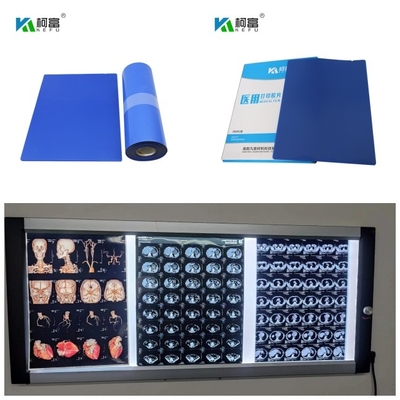 Медицинские голубые низкопробные чернила 14inch x краски DR CT MRI фильма струйных принтеров x Рэй 125 листов свертывают 10x12