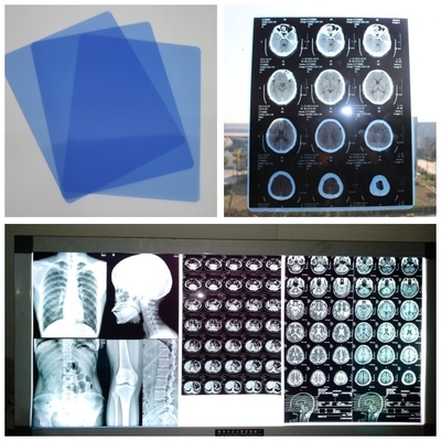 синь фильма 210um струйная медицинская x Рэй для кассеты цифров DR CT MRI с листами 8x10