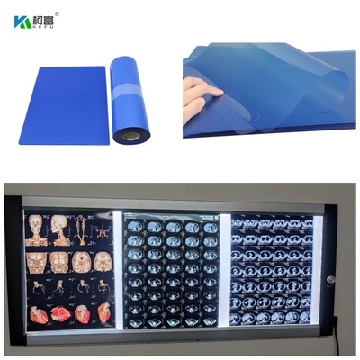 фильм 210microns струйный медицинский x Рэй для изображения CT DR MRI и 3D CT MRI вывел наружу 14x17
