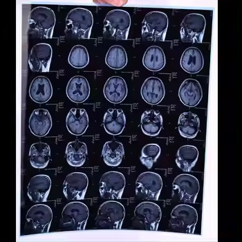 Синяя медицинская рентгеновская пленка для струйных принтеров с высокой остротой и низким содержанием тумана
