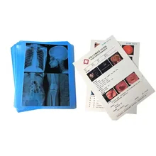 Совместимость принтеры Canon / Epson Inkjet Inkjet X Ray Film 210 микронов Толщина синего пленки