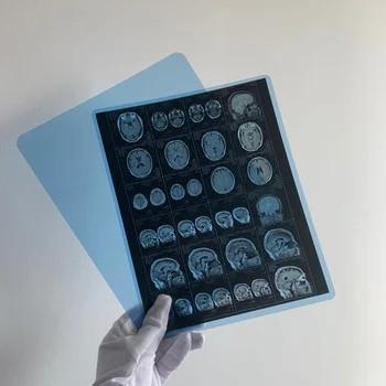 Медицинская рентгеновская сухая пленка медицинская рентгеновская струйная пленка с четким качеством изображения