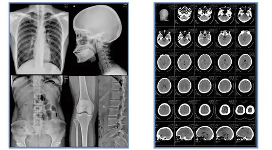 Лист голубая рентгеновская пленка чернила медицинская сухая пленка Clear Image