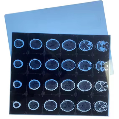 Лист голубая рентгеновская пленка чернила медицинская сухая пленка Clear Image