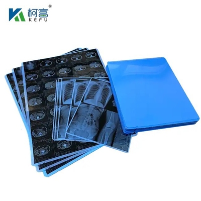 Dicom Software Printing Inkjet X Ray Blue Medical Film для компьютерного и компьютерного изображения