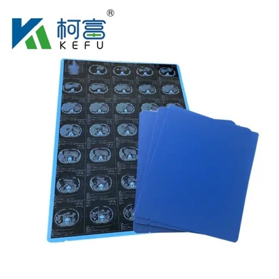 A3 Custom Size Sheets Rolls Blue Inkjet Medical Film для печати медицинского изображения рентгеновского изображения CT, CR, DR, MTR