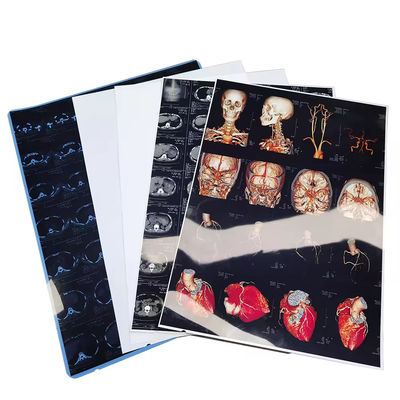 Высокое разрешение Синие белые медицинские рентгеновские пленки с глянцевой поверхностью