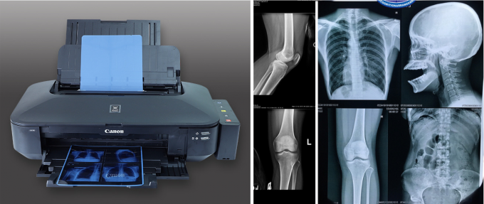 Прозрачная голубая рентгеновская пленка для компьютерного томографа DR МРТ 3